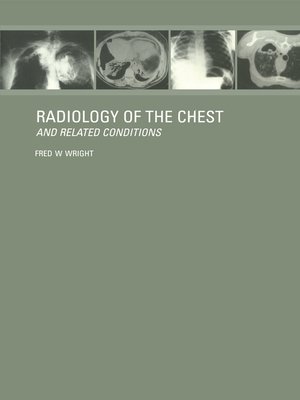 cover image of Radiology of the Chest and Related Conditions